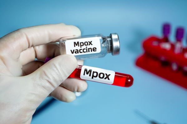 Mpox : les directives cliniques mises à jour pour les professionnels de la santé (SPF Santé publique)